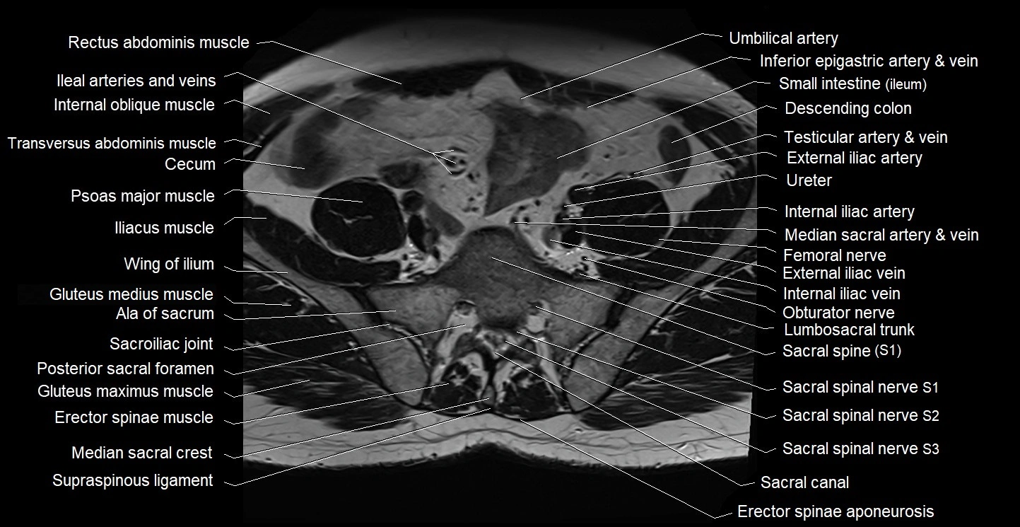 Male pelvis axial cross sectional anatomy image 1.webp